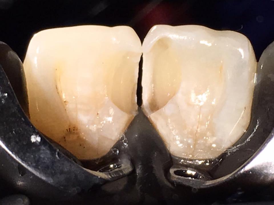 Стоматолог: проблемы с зубами влияют на иммунитет человека и могут привести к отказу почек