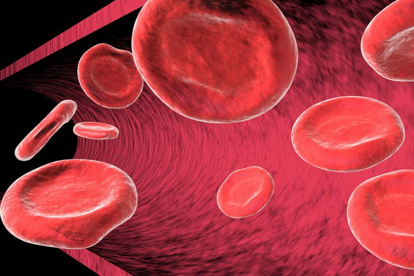 Врач Мясников: Железодефицитная анемия является неочевидным признаком рака у мужчин