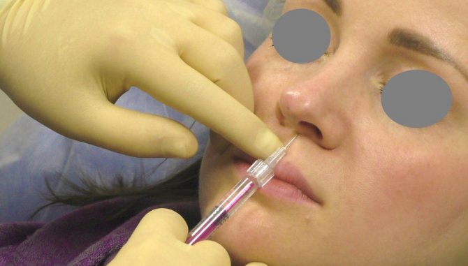Пластический хирург: введение ботокса в область носа может обернуться слепотой