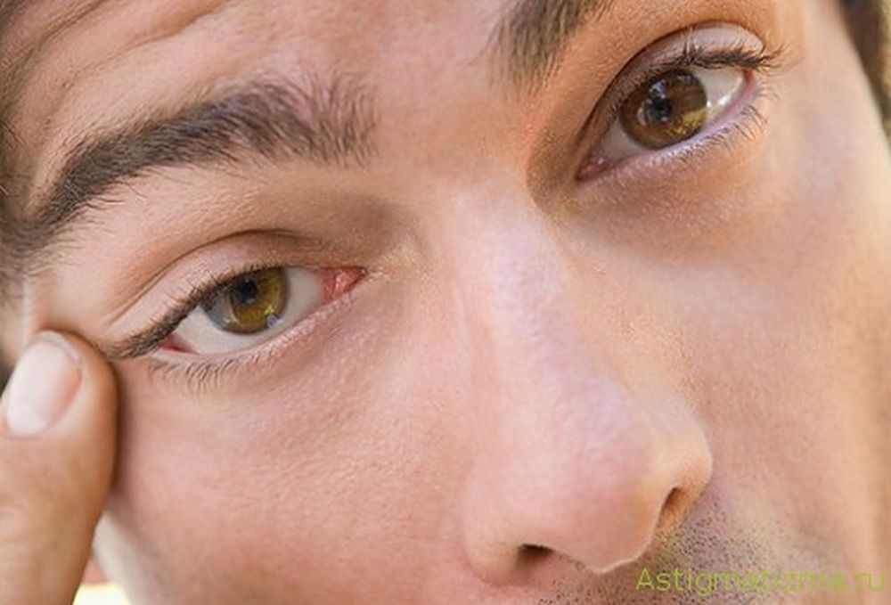 Невролог: подергивание глаза может быть от усталости, стресса или кофеина