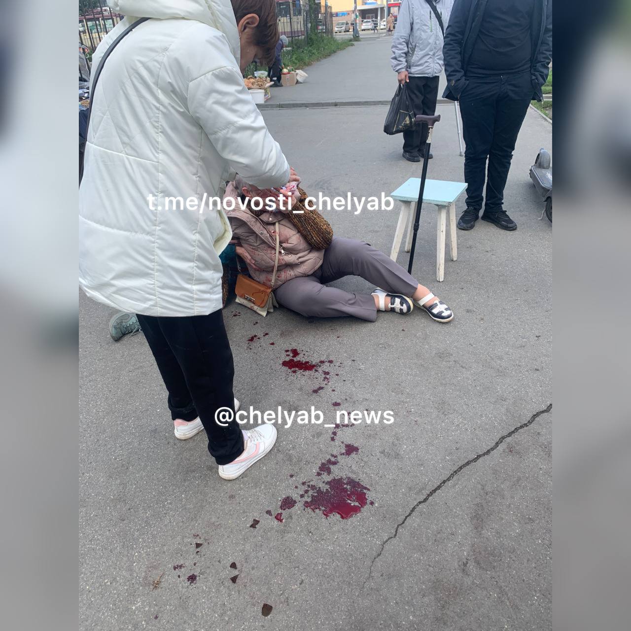 74.ru: пенсионерка попала в больницу после того, как ее сбил подросток на самокате