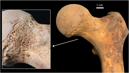 Токсикологи обнаружили в костях бедных итальянцев XVII века следы конопли
