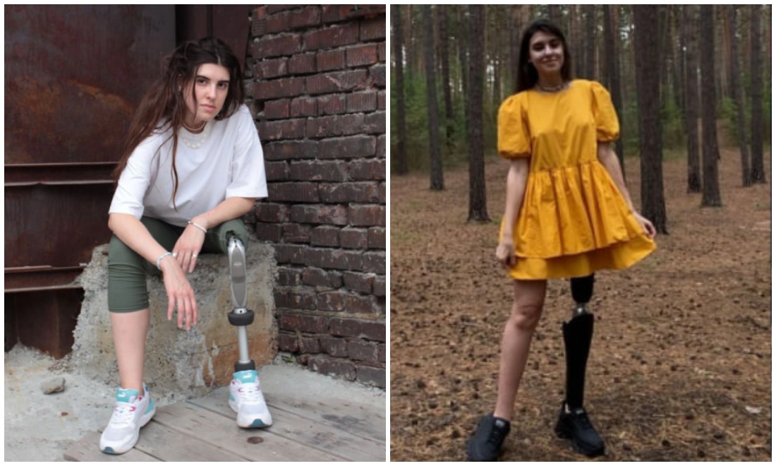 31-летняя сибирячка без ноги приняла участие в модном показе