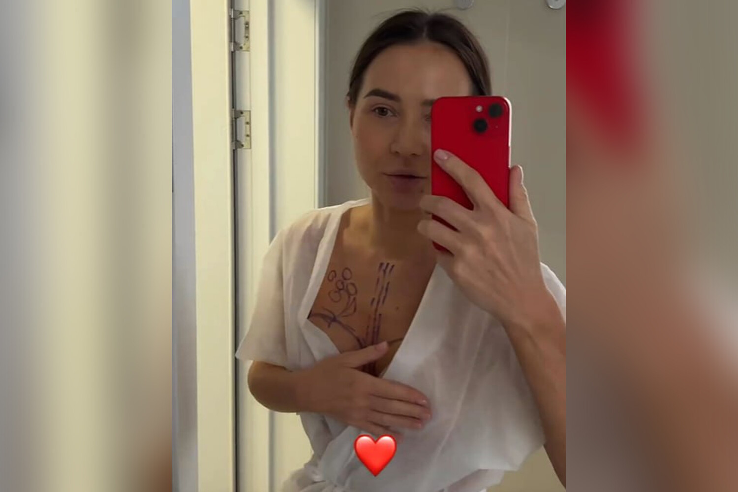 СМИ нашли, что блогерша Лерчек сделала маммопластику у Хайдарова